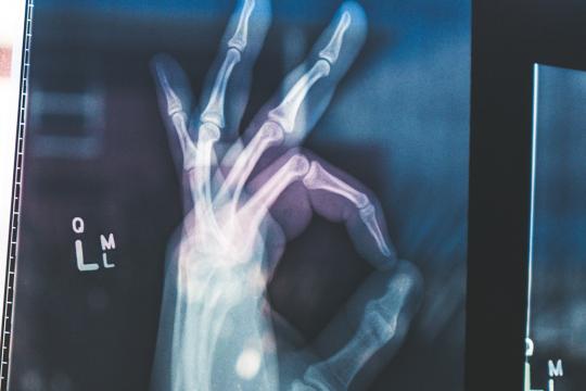 käe röntgenpilt